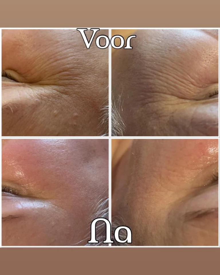 Instagram post from skin_improve. This post is in position 3.